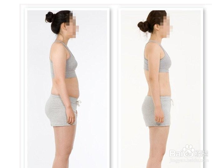 探索美丽新境界，大腿吸脂减肥术的全面解析