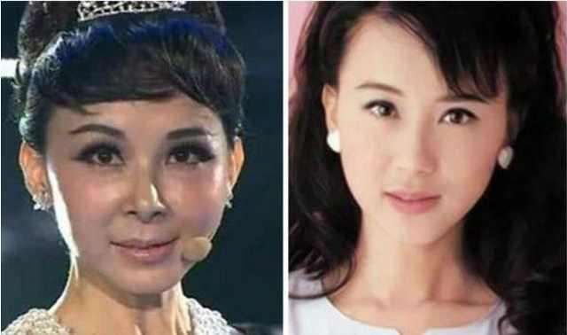 明星整容失败，光鲜背后的隐痛