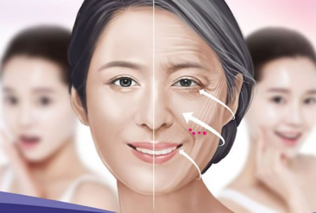 瘦脸针，价格与效果的微妙平衡