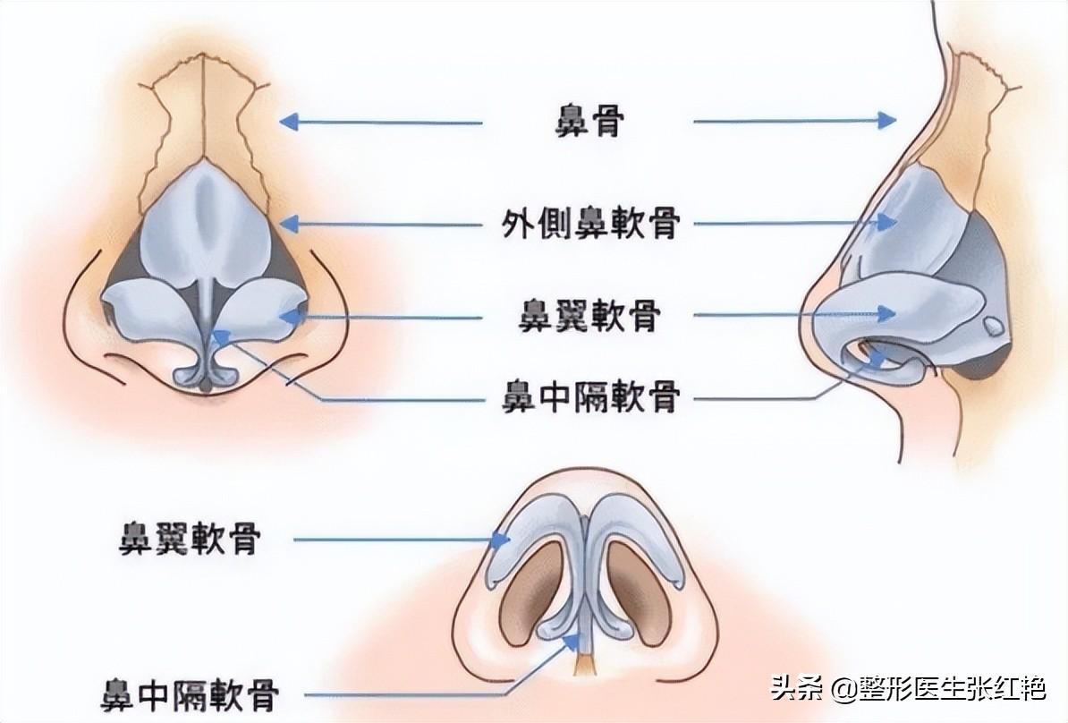 鼻翼宽整形，重塑自信的美丽之旅