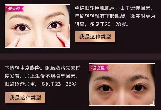 眼睛除皱，解锁年轻视界的秘密