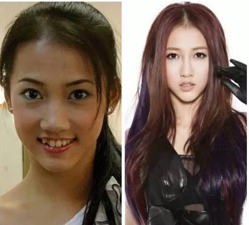 弦子整容，美丽背后的代价与思考