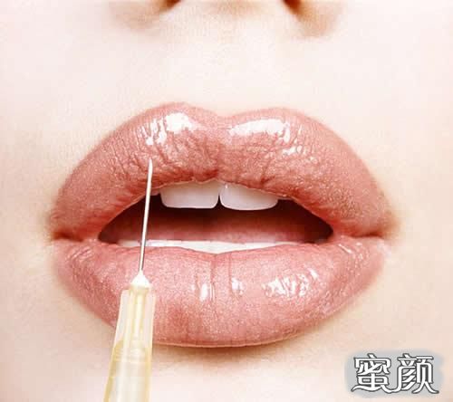 丰唇注射，美丽与安全的双重考量