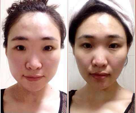 怎样可以瘦脸，科学方法与日常习惯的完美结合