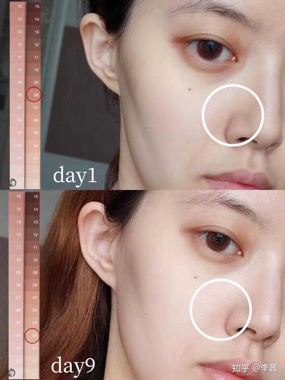 美白针，科学美白的秘密武器