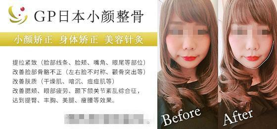 精致小颜
