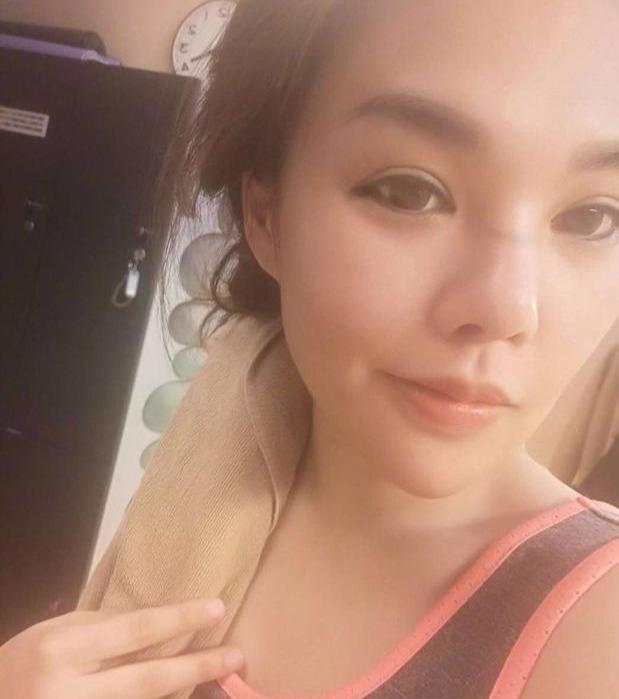 探索美丽之旅，做隆胸手术的心路历程与注意事项