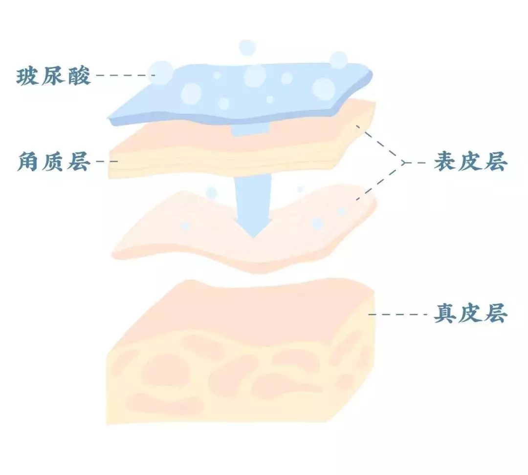 玻尿酸